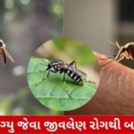 How To Protect from Dengue: ડેન્ગ્યુના કેસમાં સતત વધારો થઈ રહ્યો છે, જાણો ડેન્ગ્યુના લક્ષણો શું અને તેનાથી કેવી રીતે બચવું?