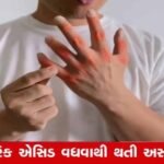 Uric Acid:  યુરિક એસિડ વધવાથી શરીરના અંગો પર થાય છે ભયંકર અસરો, જાણો