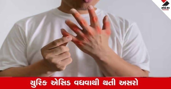 Uric Acid:  યુરિક એસિડ વધવાથી શરીરના અંગો પર થાય છે ભયંકર અસરો, જાણો
